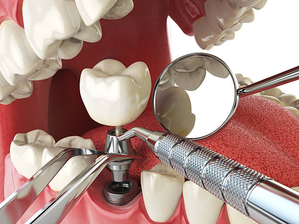 Best Emergency Dental Services for Seniors in Newton, IL